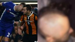 Así quedó Ryan Mason tras fractura de cráneo hace un año