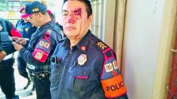 Policía intenta ayudar a hombre en silla de ruedas y le parten la cara, en Taxqueña