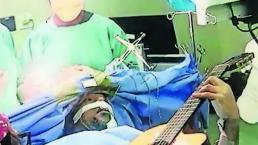 Se pone a tocar la guitarra mientras le operan la cabeza, en Sudáfrica