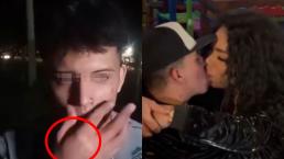 Novio de Paola Suárez niega haberle dado brutal golpiza, pero mano hinchada levanta sospechas