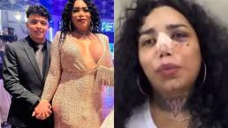 Fan se tatúa la cara de Paola Suárez desfigurada tras golpiza de su novio y divide opiniones