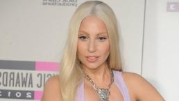 Lady Gaga hace topless en Instagram